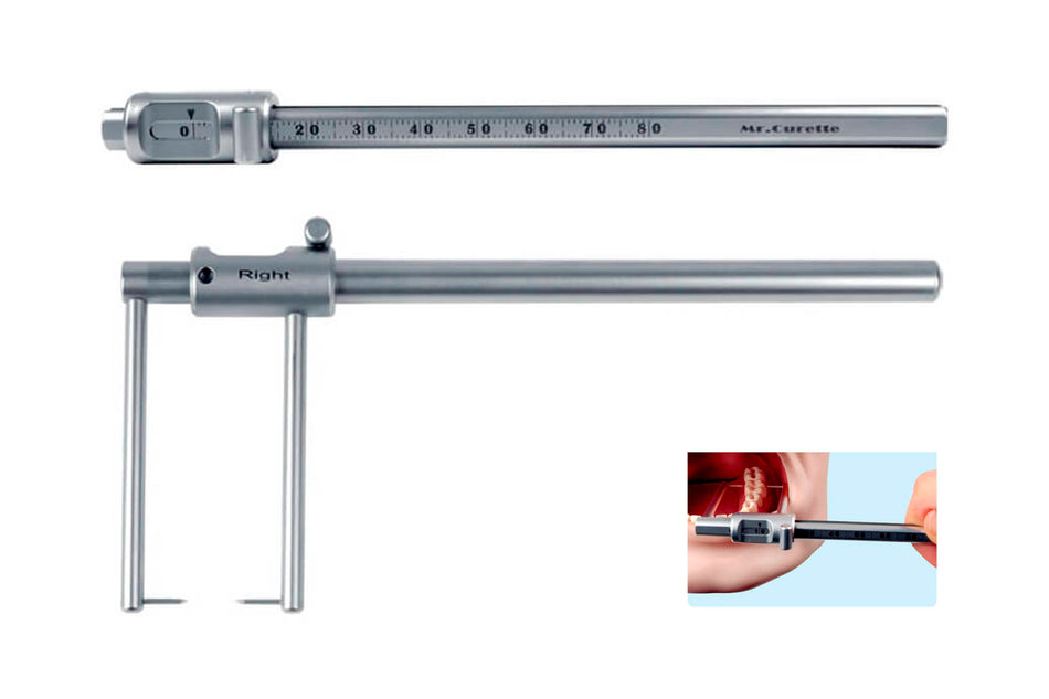 Alveolar thickness gauge
