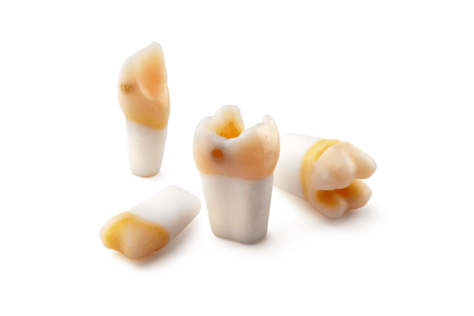 4D training teeth and educational models: Tooth 36