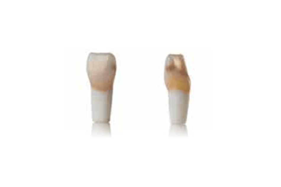 4D training teeth and educational models: Tooth 11