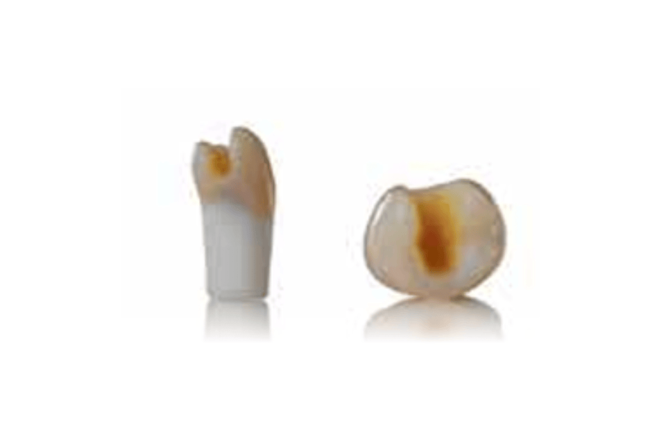 4D training teeth and educational models: Tooth 35