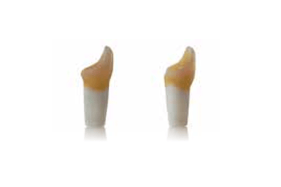 4D training teeth and educational models: Tooth 11