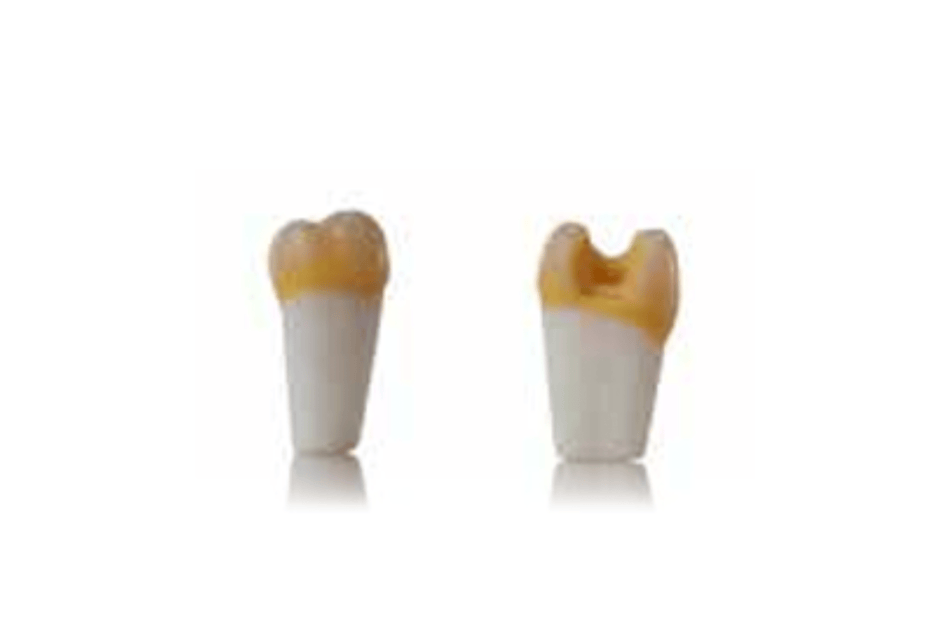 4D training teeth and educational models: Tooth 17