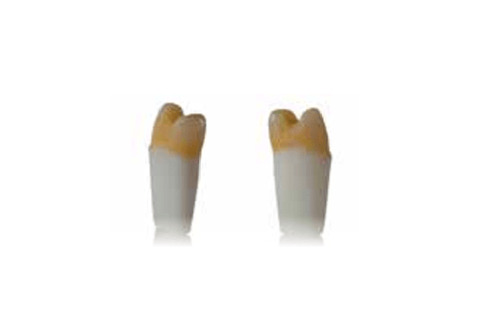4D training teeth and educational models: Tooth 24