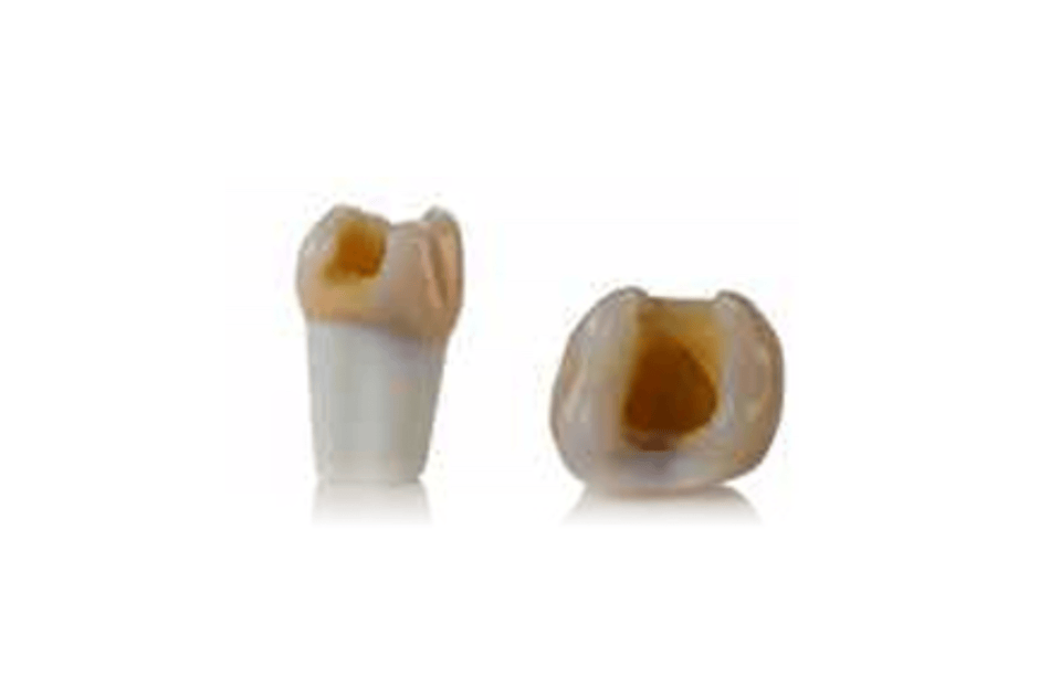 4D training teeth and educational models: Tooth 26