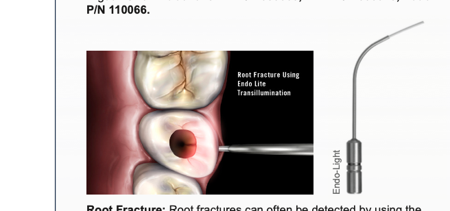 Microlux Endo guide 1 mm