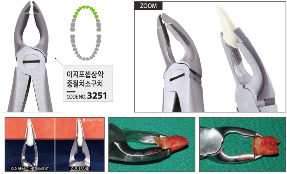 Easy forceps ekstraktionstang