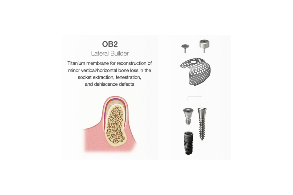 OssBuilder OB2, lateral Builder - 1 Wall