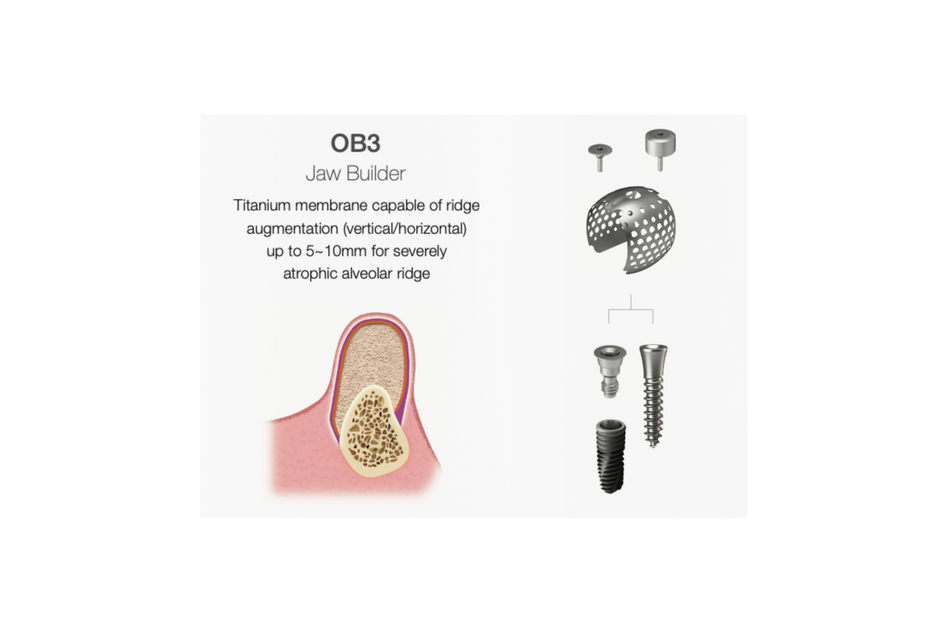 OssBuilder OB3, Jaw Builder horizontal 20 mm