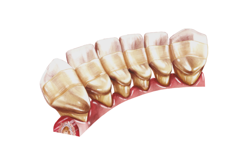 Comcord composite tape with fiber reinforcement, packing with 6 cm